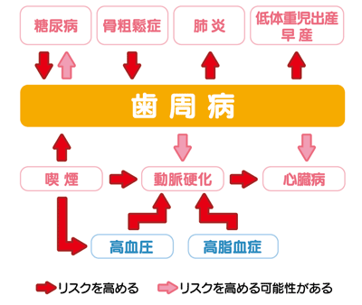 歯周病は肺炎や低体重児出産・早産のリスクを高め、また糖尿病・動脈硬化・心臓病のリスクを高める可能性があると言われています。一方、糖尿病のほか、骨粗鬆症や喫煙も歯周病のリスクを高める要因となっています。